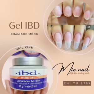 gel ibd